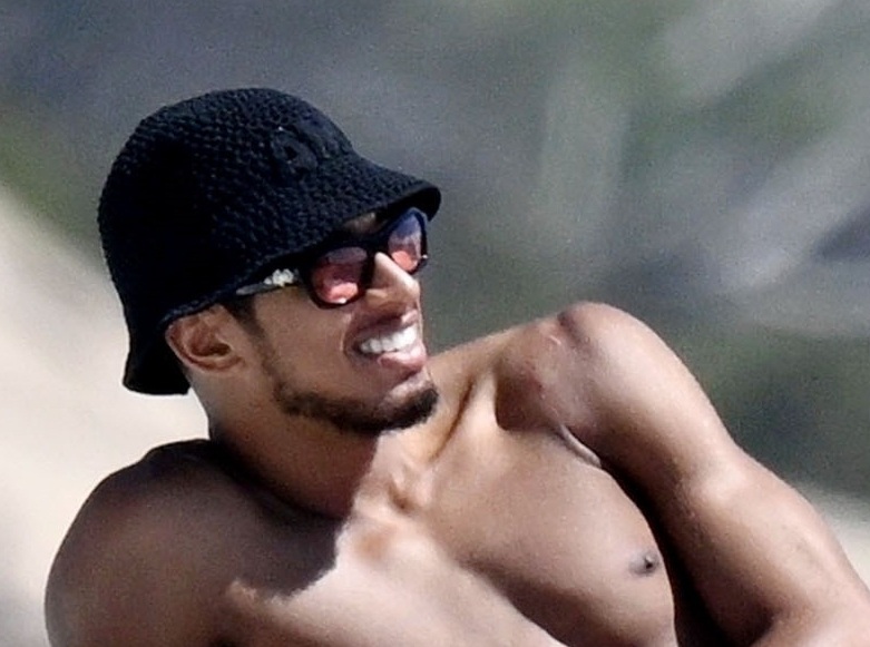 Jude Bellingham lộ sẹo vai sau phẫu thuật_692804006aa1d.jpeg