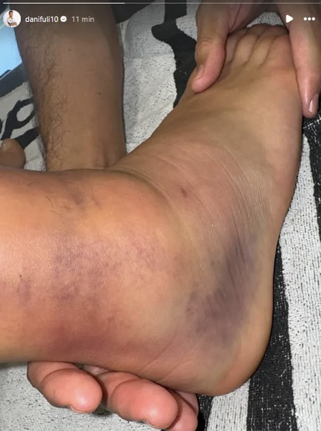 Rợn người với chấn thương của sao Real Madrid_695bbb516b37e.jpeg