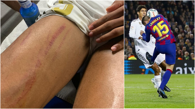 Sao Real phá vỡ im lặng, vạch trần sự thật bị hàng thủ Barca chơi xấu_695c9f7a92c58.jpeg