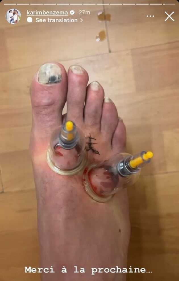 Xót xa trước bàn chân đầy thương tích của QBV thế giới_695c1e9c1e809.jpeg